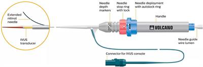 The Use of Re-entry Devices in Aortoiliac Occlusive Disease